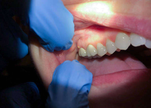 Best Tooth Infection Emergency Dentist  in Marysville, MI