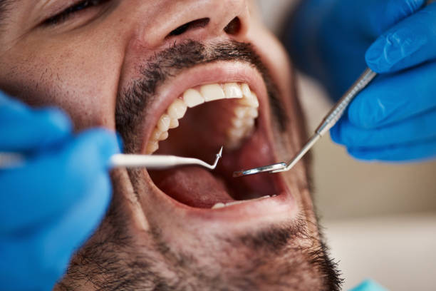 Best Emergency Tooth Extraction  in Marysville, MI